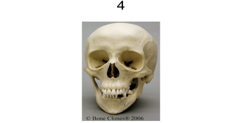 The efficacy and function of Huangni skeleton